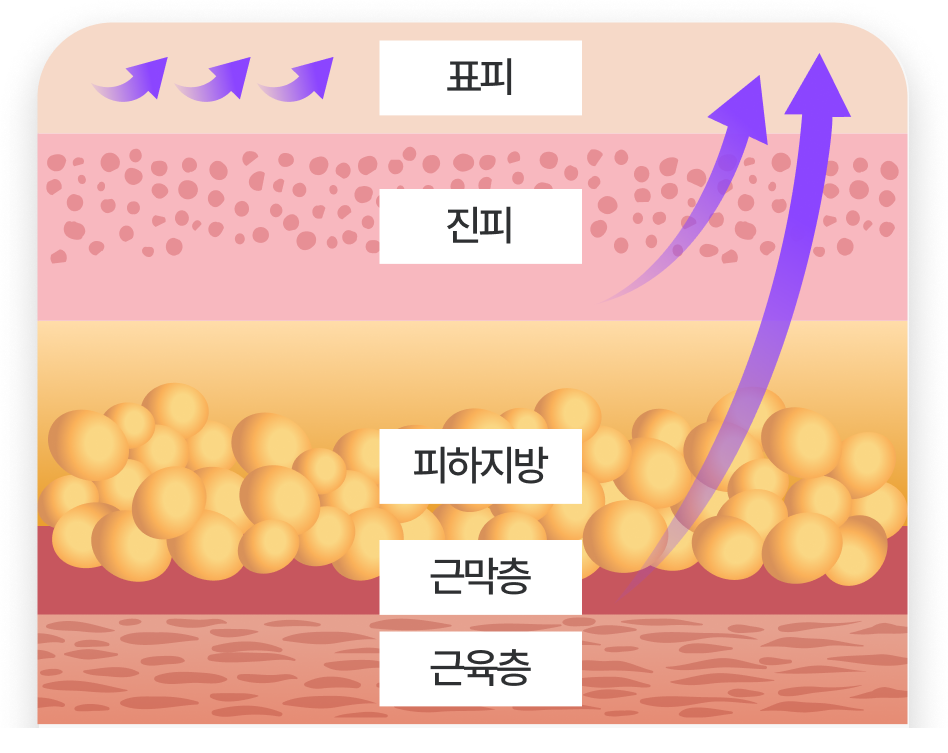 강남역성형외과 스마일거상 볼륨까지 살리는 반거상 리프팅의 핵심은? 관련 이미지 8