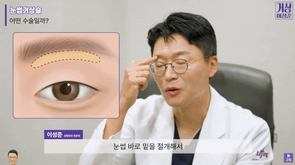 졸린눈수술 찾고 있다면 관련 이미지 3