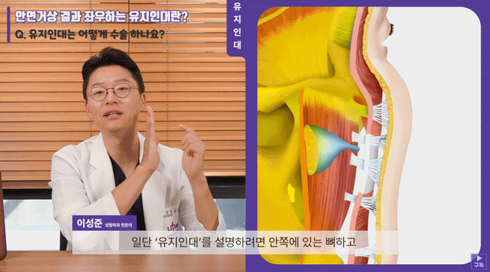 서초성형외과 의료진이 설명하는 안면거상의 모든 것 관련 이미지 4