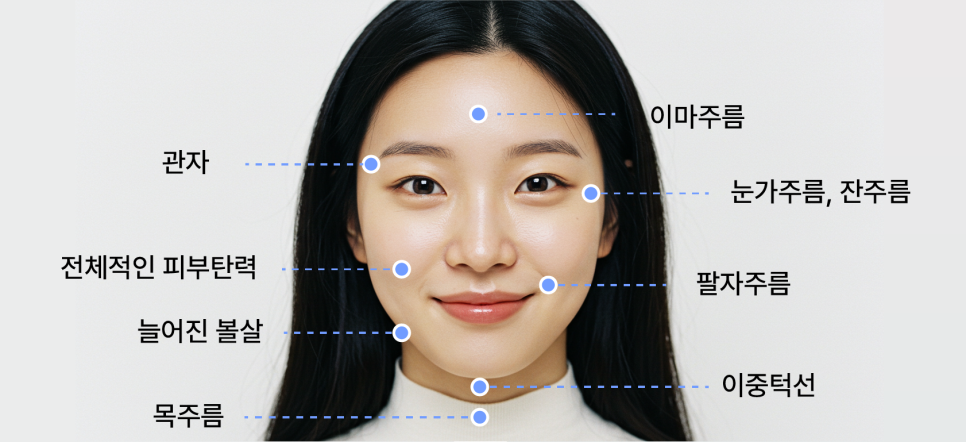 일산성형외과 안면거상후기 얼굴은 팽팽해졌는데, 왜 목주름이 더 눈에 띄는 걸까요? 관련 이미지 4