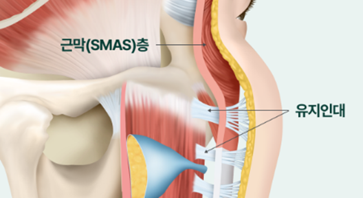 A Story That People Worried About Facelift Scars in Sinsa Station Plastic Surgery Should Definitely Read image 4