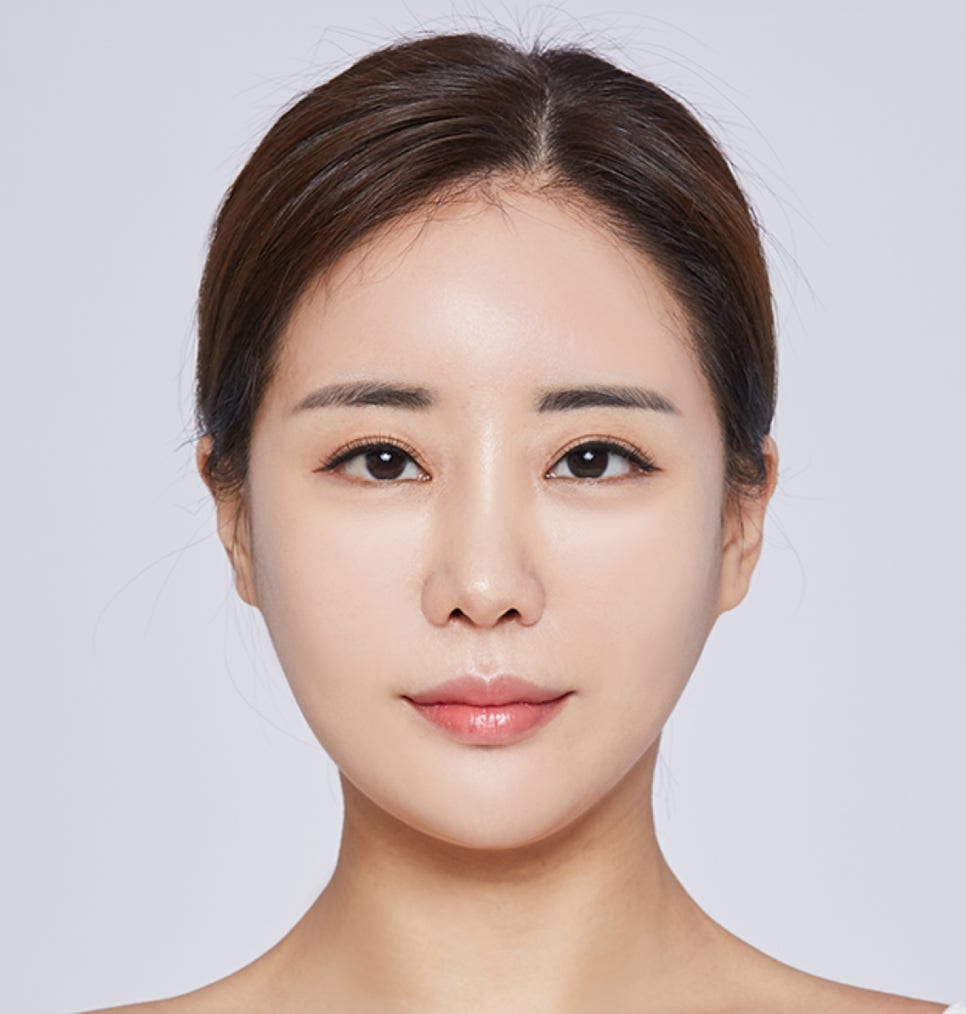 미니리프팅 부작용 피하기 위한 <체크사항> 관련 이미지 6