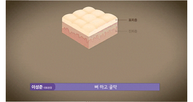 윤곽성형을 고민하게 되는 광대콤플렉스, 원인은 뼈만이 아닙니다 관련 이미지 7