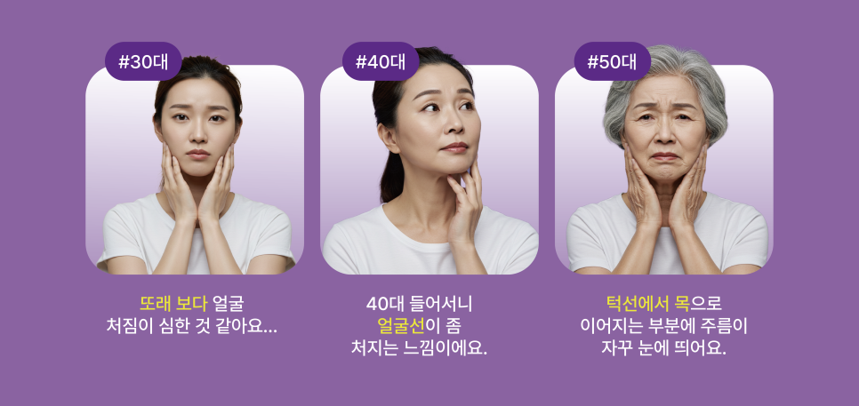 여름철 리팅의원 강남미니리프팅 많은 이들이 찾는 이유는? 관련 이미지 10