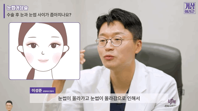 눈썹거상술 비용 가격 알고 싶다면 관련 이미지 11