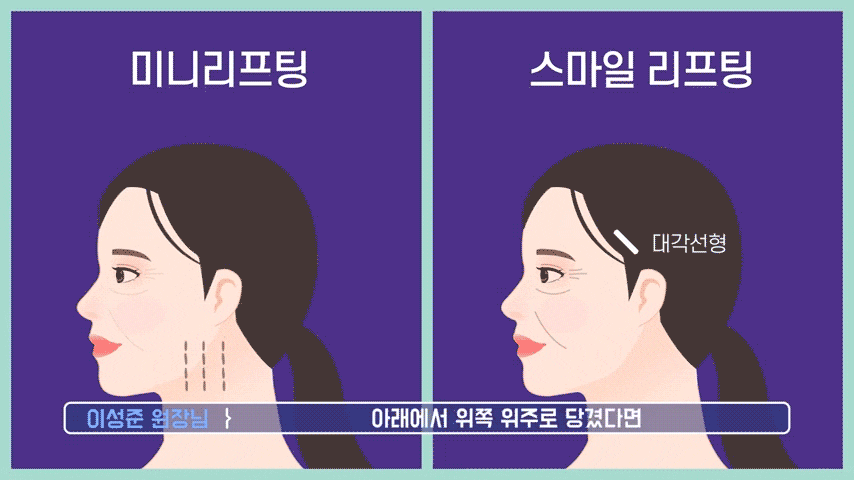 Key Guide to Choosing a Mini Facelift Lifting Plastic Surgery Clinic! (Natural Improvement of Facial Contours in Summer) image 7