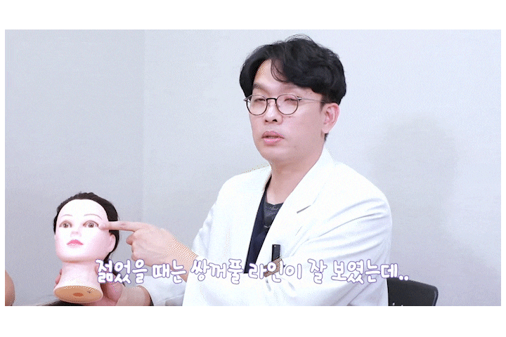 Why Forehead Thread Lifting and Drooping Eyelid Lifting Should Be Considered Together image 4