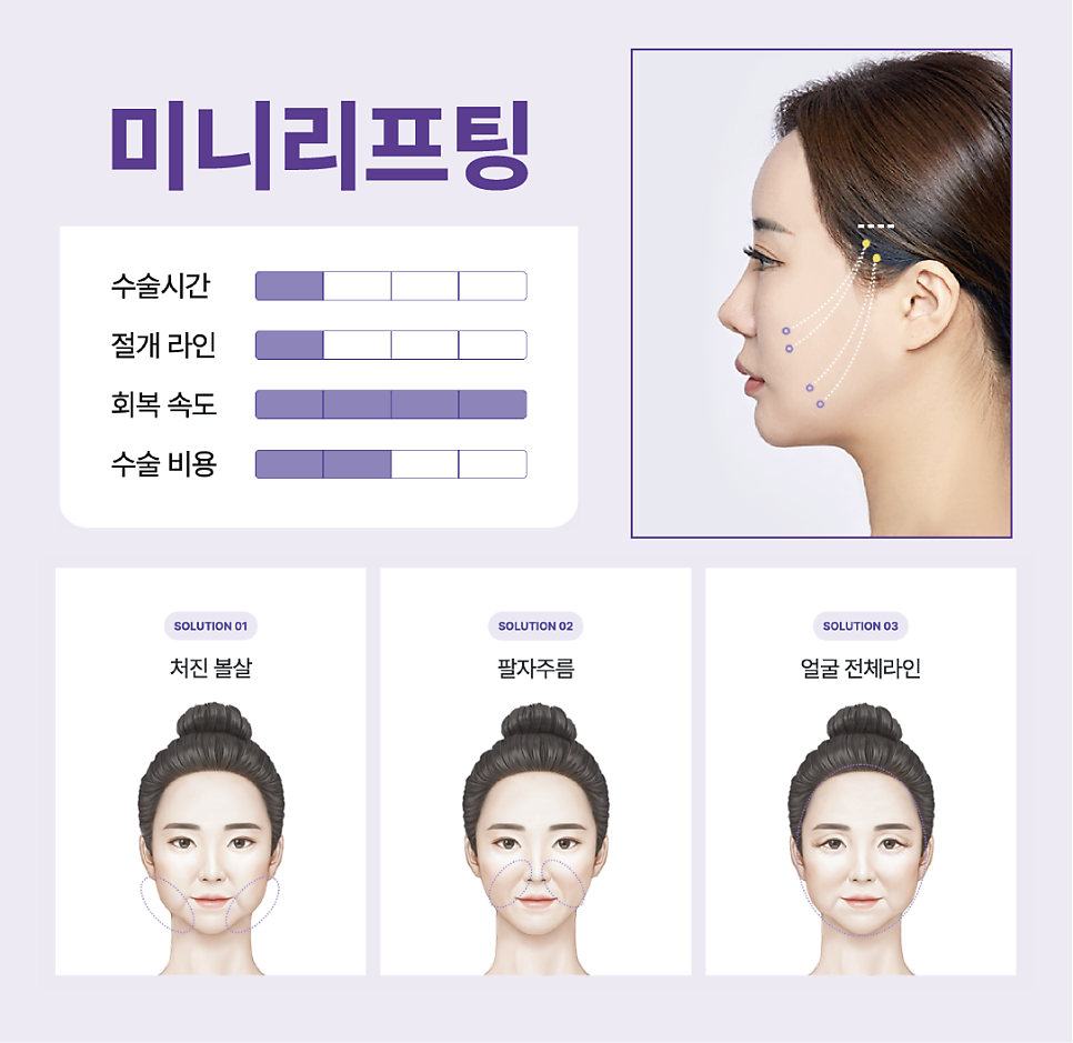 여름철 리팅의원 강남미니리프팅 많은 이들이 찾는 이유는? 관련 이미지 5