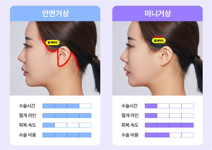 Key Guide to Choosing a Mini Facelift Lifting Plastic Surgery Clinic! (Natural Improvement of Facial Contours in Summer) image 3