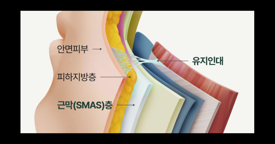 일산성형외과 안면거상후기 얼굴은 팽팽해졌는데, 왜 목주름이 더 눈에 띄는 걸까요? 관련 이미지 9