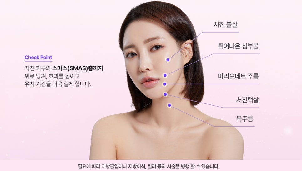 Neck wrinkle treatment cost: Related information you must check before treatment image 5