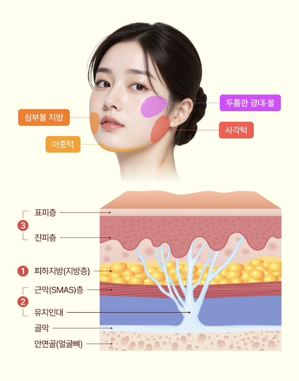 동안얼굴, 윤곽성형의 흐름이 바뀌다 | 미니윤곽술 서울점의 접근법 관련 이미지 10
