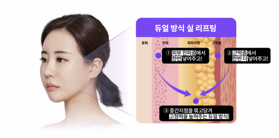 얼굴주름리프팅 실리프팅비용, 여름철에도 걱정 없이 시술 가능한 진짜 이유?! 관련 이미지 10