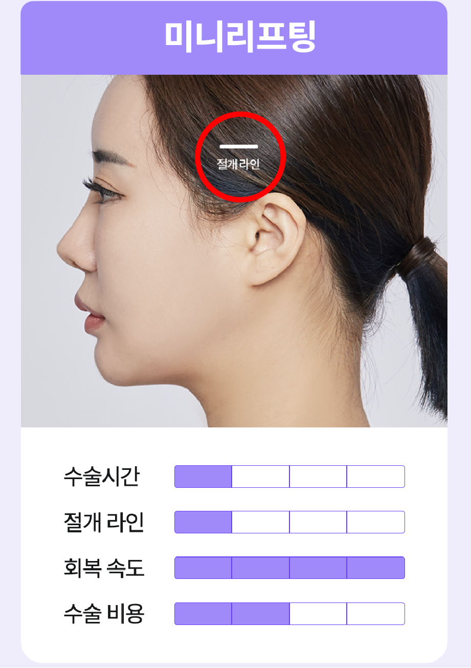 미니리프팅후기 신사역리프팅: 수술 원리와 선택 시 알아둬야 할 포인트 관련 이미지 6