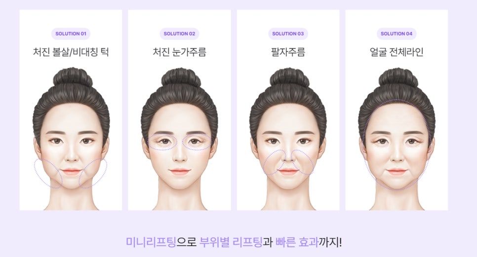 미니안면거상? 이 글로 종결합니다 관련 이미지 7