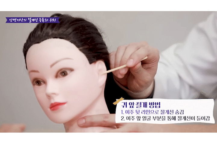 신사역리팅 안면거상술가격 차이, 비용보다 매우 중요한 건 ‘이것?’ 관련 이미지 8