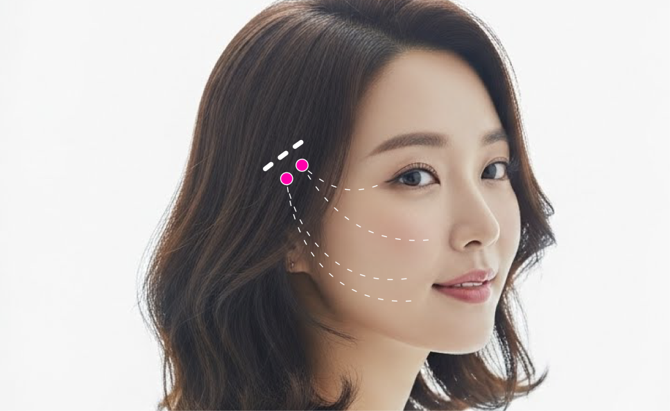 이중턱살시술, 처진얼굴리프팅후기로 확인하는 겨울철 흐려진 윤곽 라인 관리법 관련 이미지 10