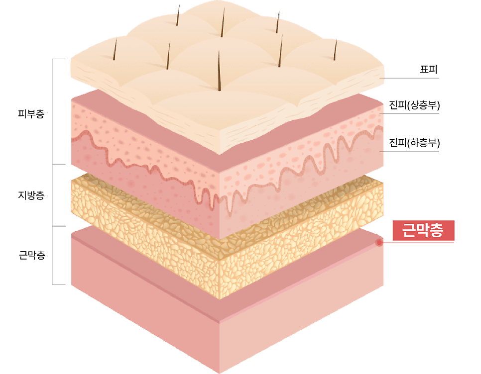 스마일리프팅가격 궁금하다면? 스마일거상과의 차이까지 한번에 정리 관련 이미지 3