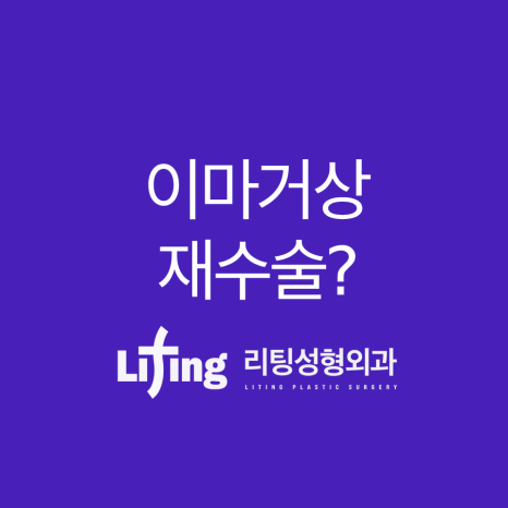 이마거상재수술? 고려하기 전에 핵심을 알아야 합니다 관련 이미지 9