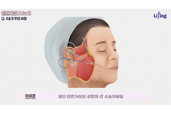 A Story That People Worried About Facelift Scars in Sinsa Station Plastic Surgery Should Definitely Read image 11