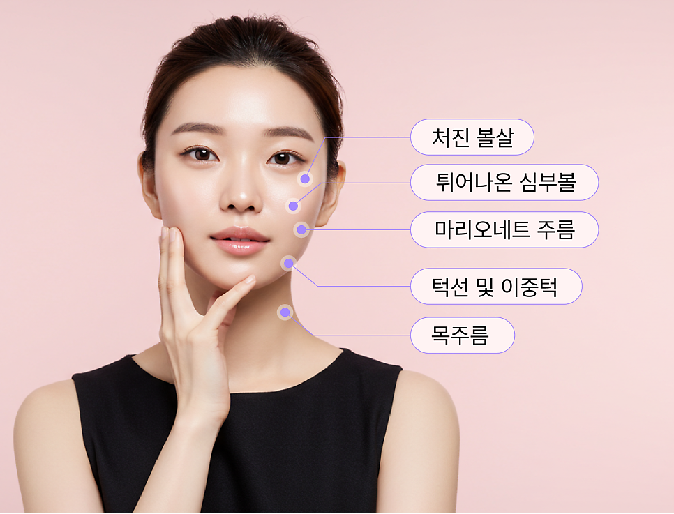 턱선리프팅 리팅미니리프팅 정보 (여름에 시너지나는 리프팅) 관련 이미지 12