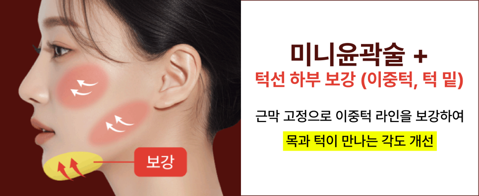 안면윤곽수술 뼈를 깎지 않고 윤곽선을 다듬는 신사윤곽성형외과 관련 이미지 16