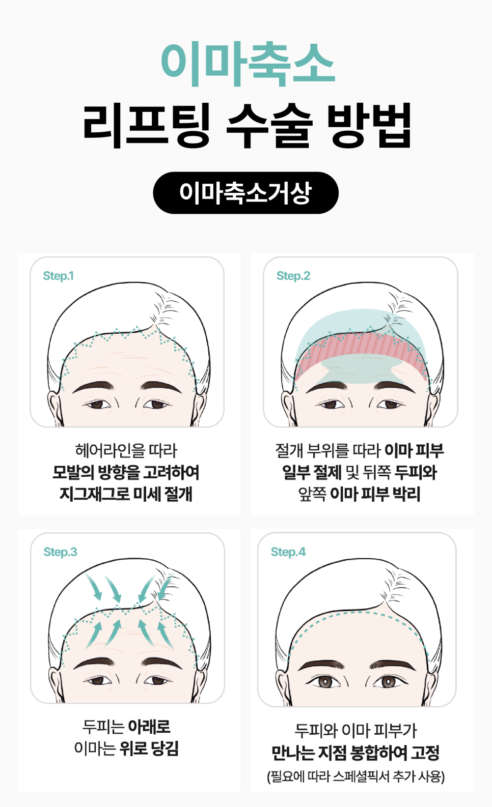 광주성형외과 이마리프팅으로 동안 인상되찾기 관련 이미지 14