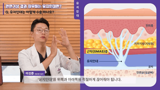Facelift Surgery at Liting Plastic Surgery, a Medical Institution Focused on Lifting image 3