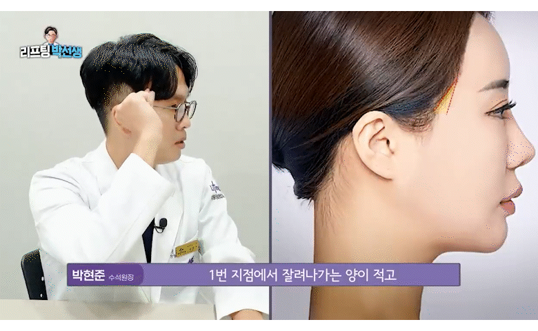 미니리프팅가격, 강남안면거상성형외과에서 보는 겨울 전 탄력 관리의 정밀 설계 관련 이미지 6