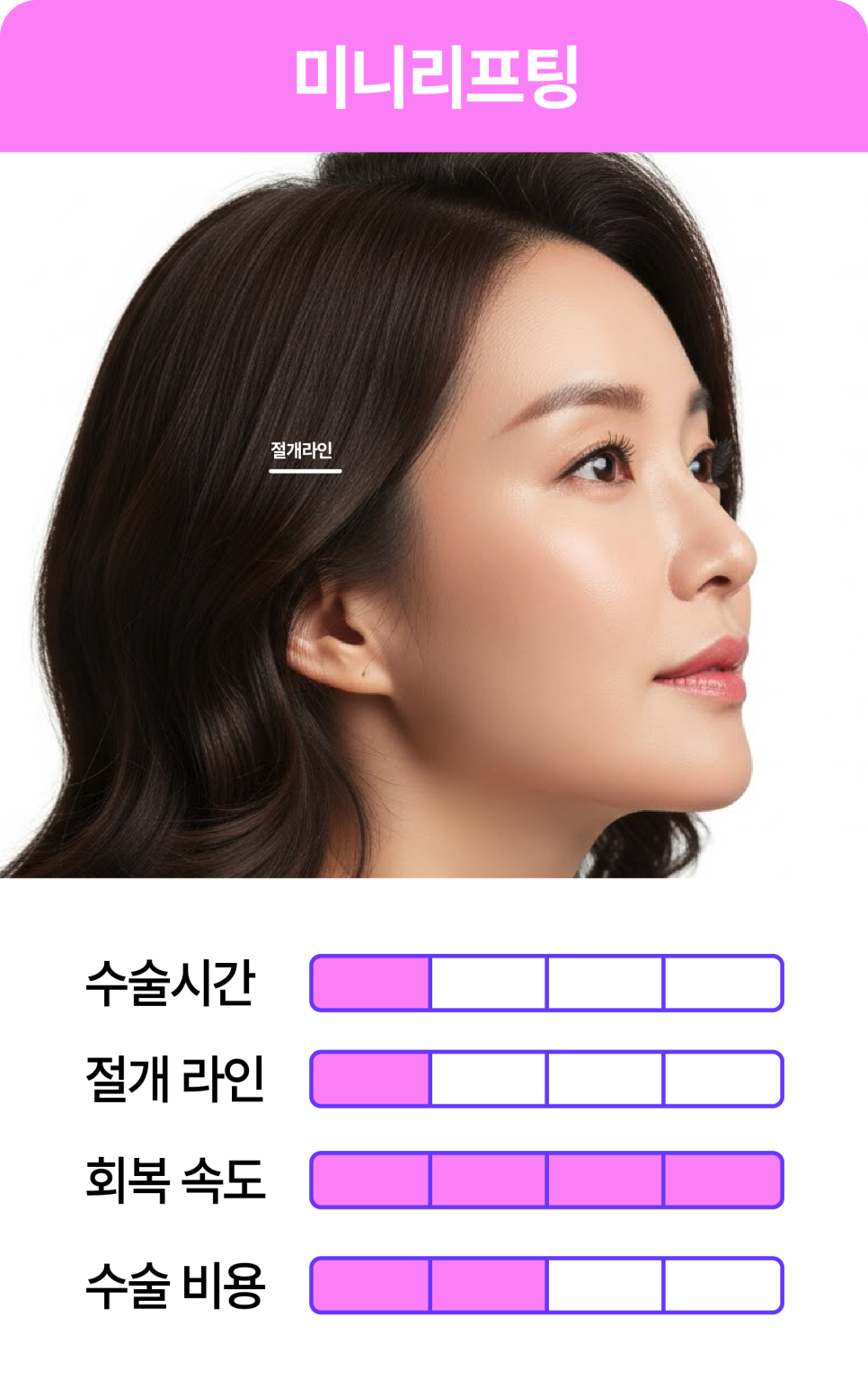 처진볼살리프팅후기에서 시작된 고민, 미니리프팅가격보다 중요한건 ‘방향’입니다 관련 이미지 5
