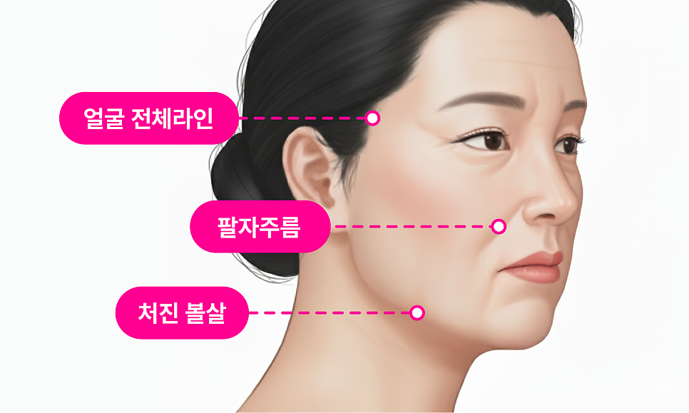 Gangnam Facelift vs. Sinsa Station Lifting: Why Is the Difference in Results So Big? image 7