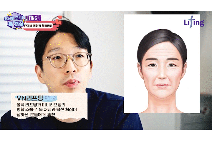 턱선리프팅 리팅미니리프팅 정보 (여름에 시너지나는 리프팅) 관련 이미지 11
