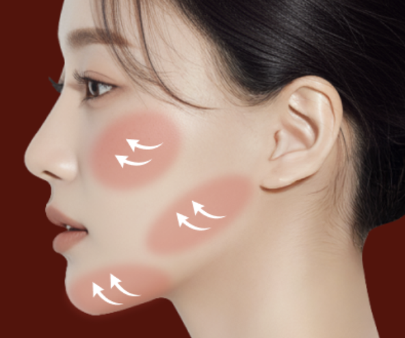 Sinsa Station Lifting Plastic Surgery Clinic Mini Contouring: How to Refine Facial Lines Without Bone Reduction | Liting Plastic Surgery Seoul Branch image 7