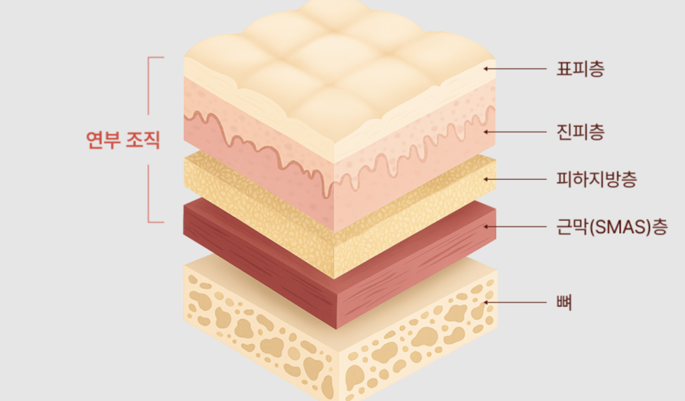 뼈 절제 없이 얼굴선 정돈, 안면윤곽수술의 또 다른 해석 | 리팅미니윤곽술 관련 이미지 11