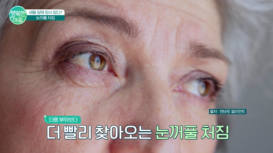 Forehead Lift for the Eyes and Overall Expression! Addressing Age-Related Changes All at Once image 2