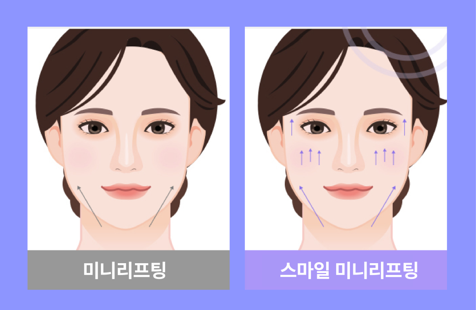 이중턱살시술, 처진얼굴리프팅후기로 확인하는 겨울철 흐려진 윤곽 라인 관리법 관련 이미지 11