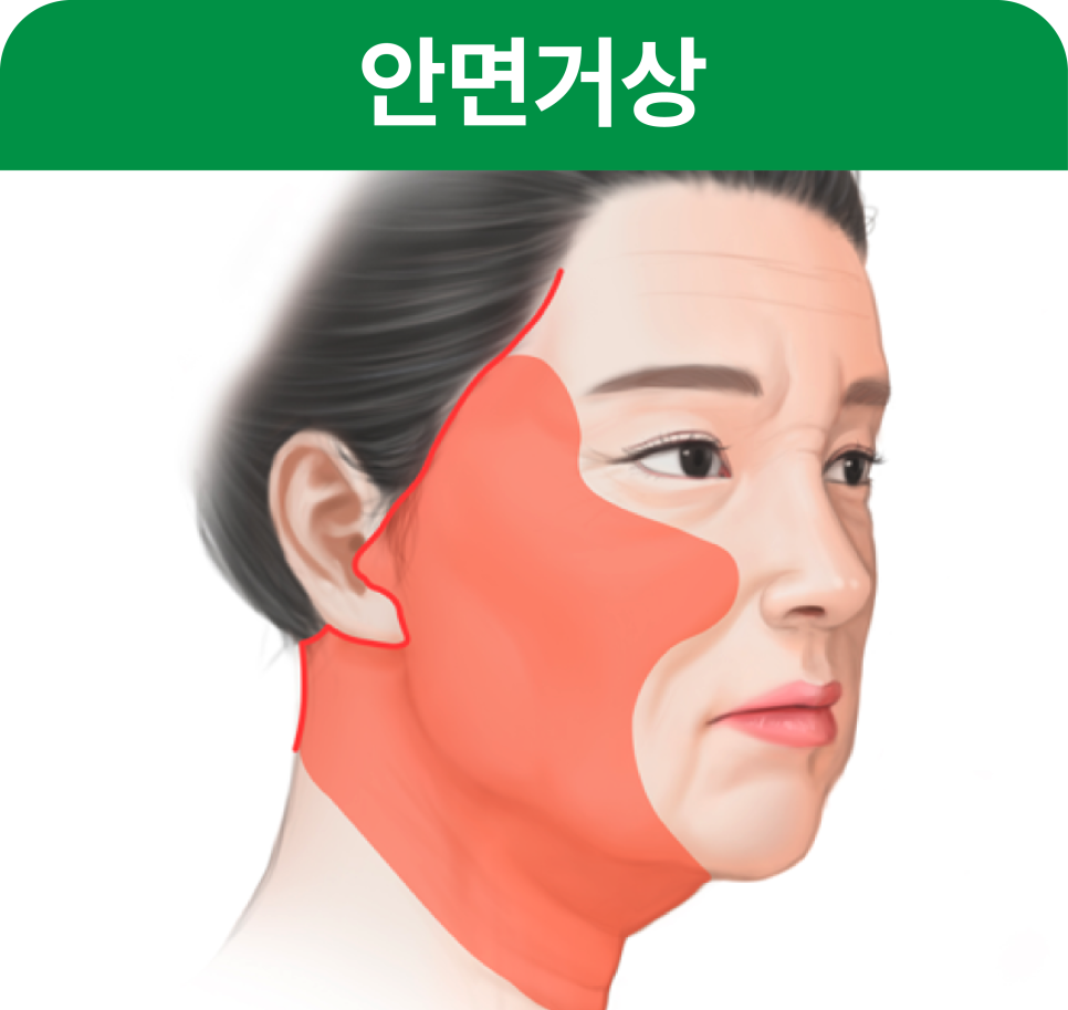 Gangnam Facelift vs. Sinsa Station Lifting: Why Is the Difference in Results So Big? image 3