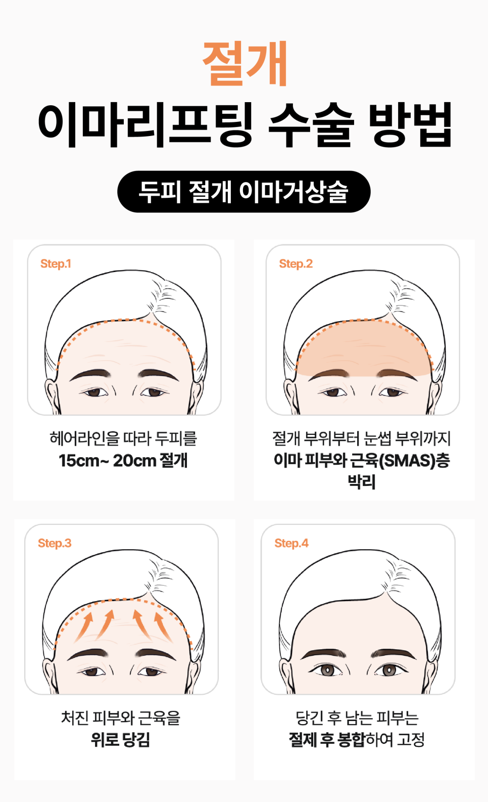 광주성형외과 이마리프팅으로 동안 인상되찾기 관련 이미지 11