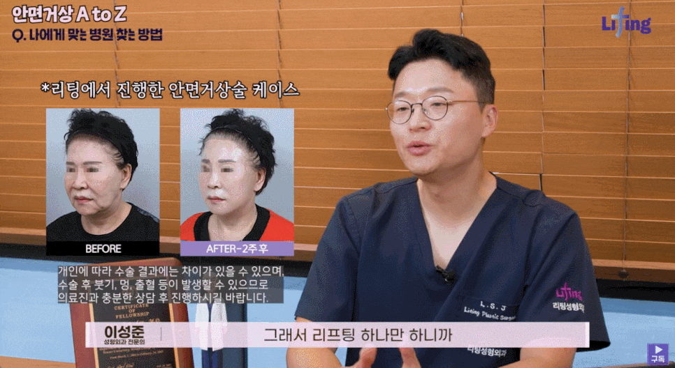 Learn the Criteria for Choosing Facelift Surgery in Gangnam image 8