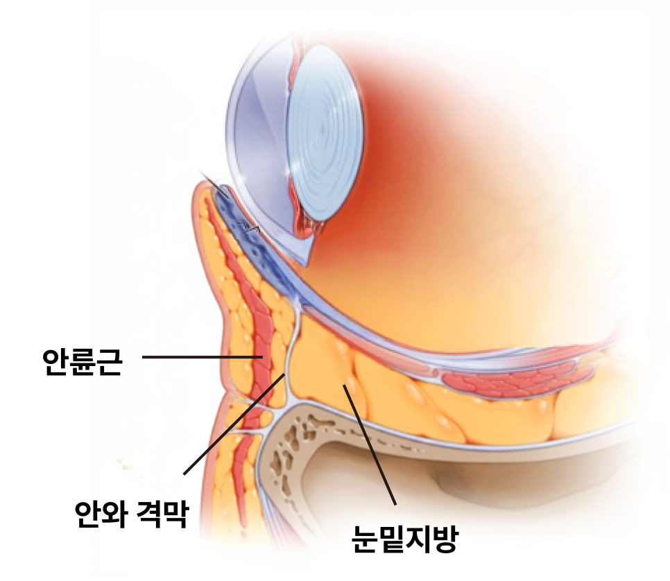 Understanding Gangnam Under-Eye Fat Repositioning, Causes of Hollow Under Eyes, and How the Structure Around the Eyes Changes with Age image 4