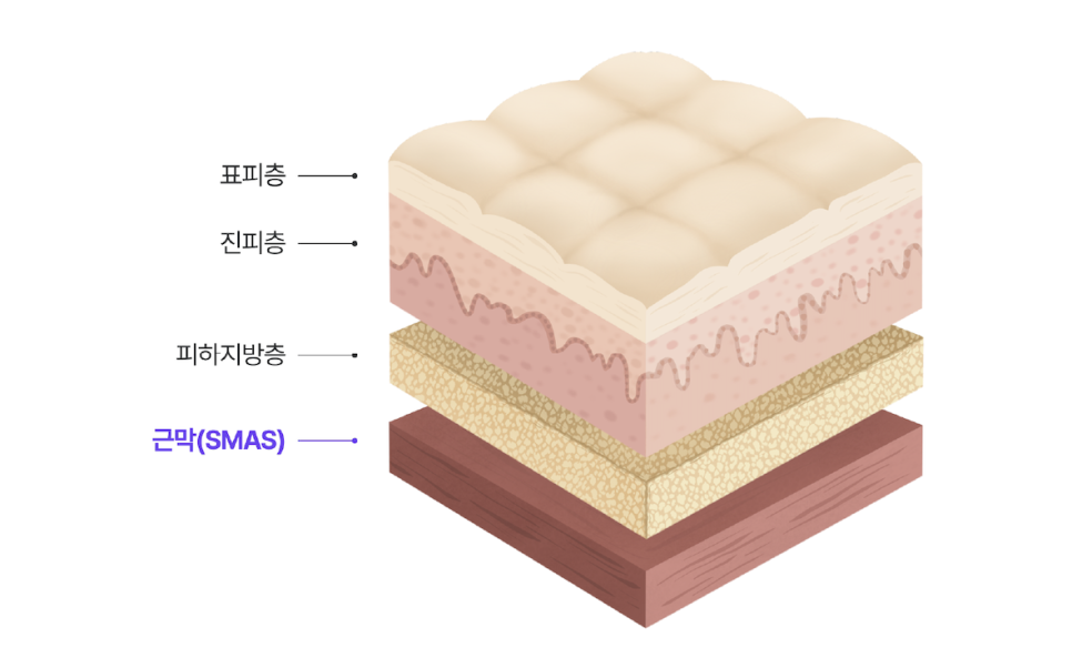 얼굴주름리프팅 실리프팅비용, 여름철에도 걱정 없이 시술 가능한 진짜 이유?! 관련 이미지 11