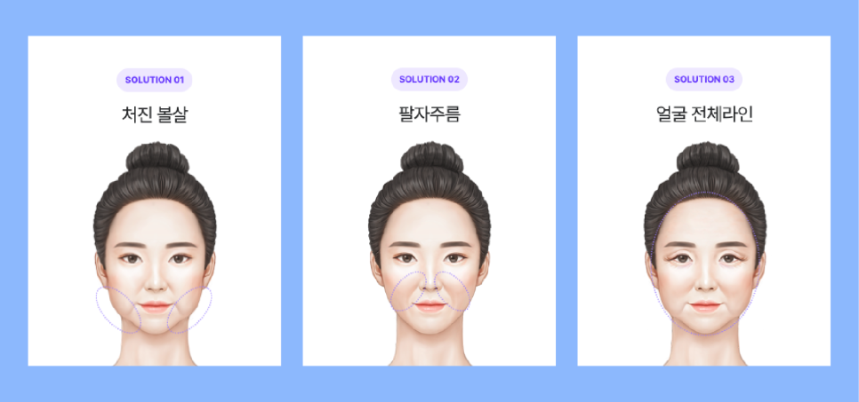 The Difference in Price Between Seoul Facelift and Mini Lifting: How to Choose a Lifting Procedure Wisely in Summer image 5