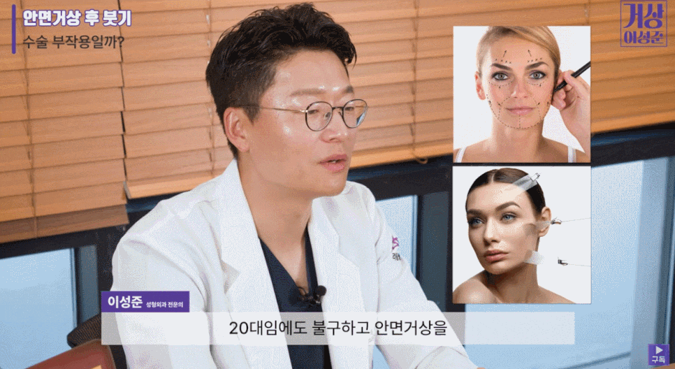 안면거상 유지기간 및 주의 사항 <총정리> 관련 이미지 2
