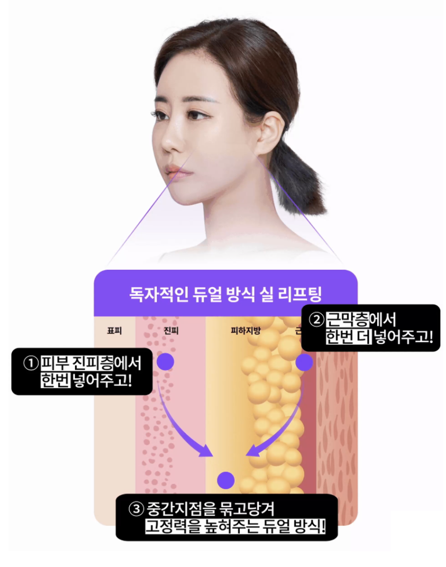 Changing Facial Contours Every Season? Finding Balance with the Mini Lifting Duration and the Approach of a Plastic Surgery Clinic in Nonhyeon-dong image 7