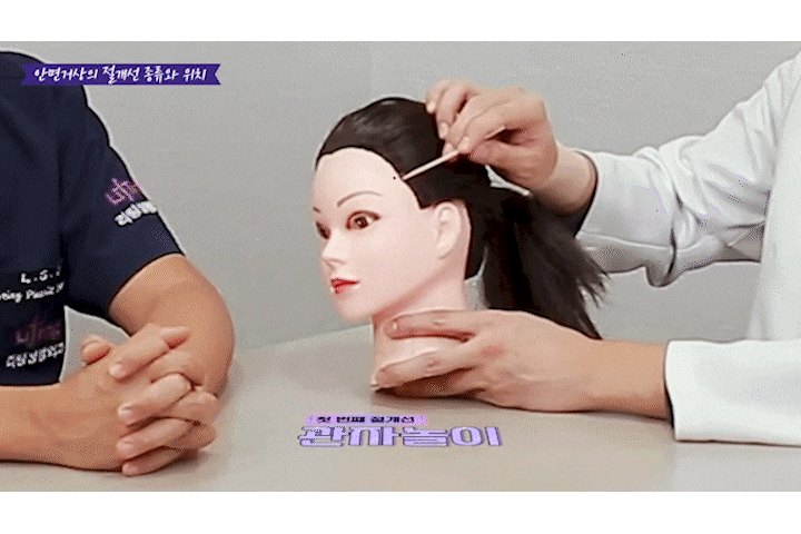 신사역리팅 안면거상술가격 차이, 비용보다 매우 중요한 건 ‘이것?’ 관련 이미지 6