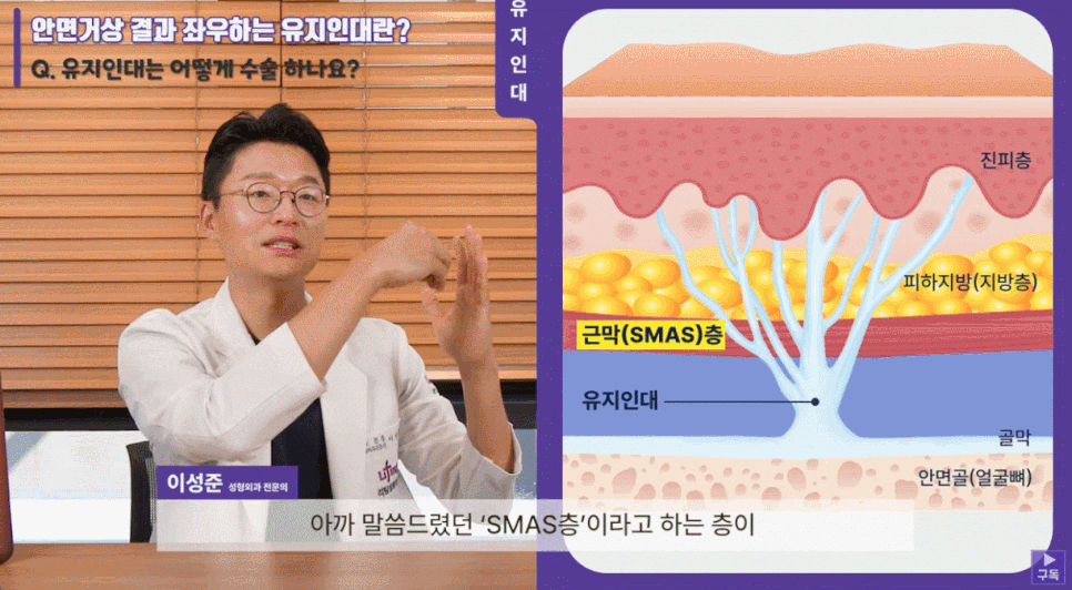 강남유명성형외과가 리프팅만 하는 이유 관련 이미지 3