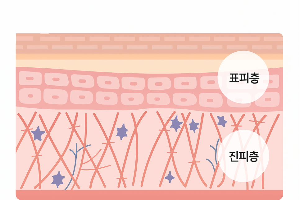 논현역성형외과 베네핏주사 수술 없이 피부 탄력 채우는 방법 관련 이미지 12