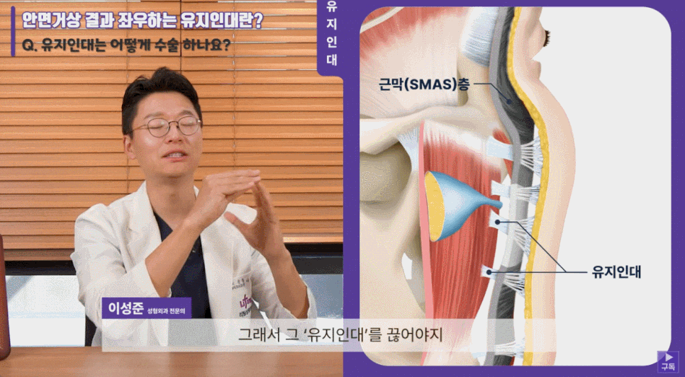 강남안면거상? 현직 의사가 답변하는 Q&A 관련 이미지 3