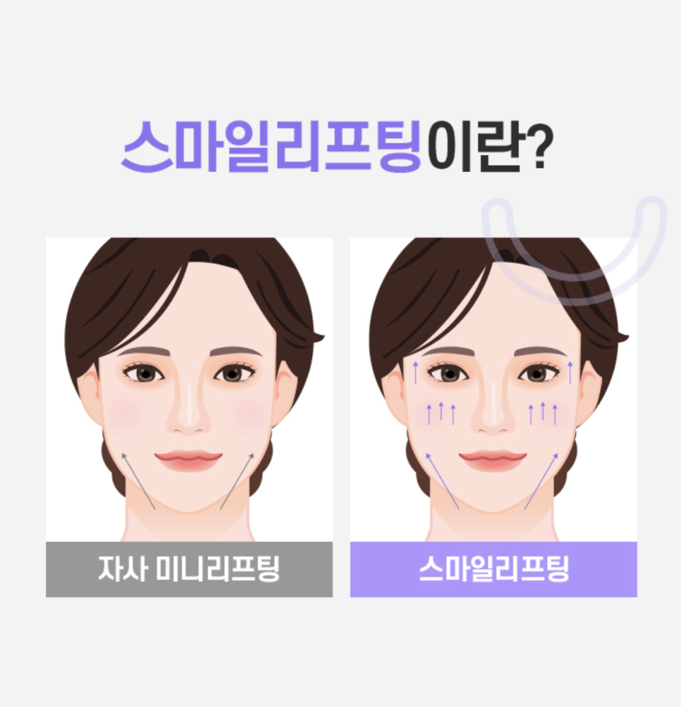 여름철 리팅의원 강남미니리프팅 많은 이들이 찾는 이유는? 관련 이미지 7