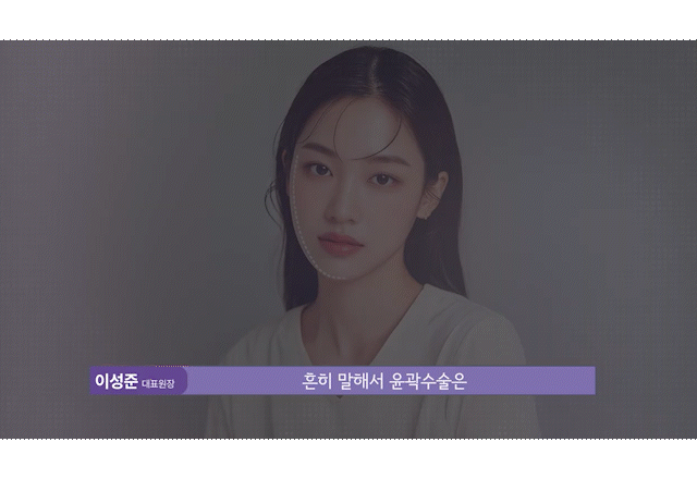 안면윤곽수술 뼈를 깎지 않고 윤곽선을 다듬는 신사윤곽성형외과 관련 이미지 3